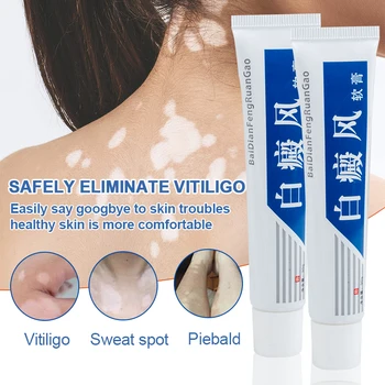 30g Jauns VitiligoTreament Krēms Antibakteriāls Krēms Psoriāzes Lokalizēts Vitiligo Ziede Balto plankumu Mycosis Leukoplakia Ārstēt Attēls 2
